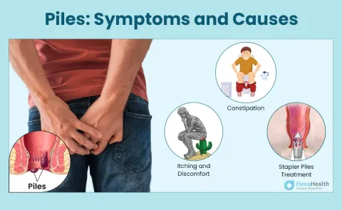 Piles: Symptoms, Images, Causes, and Types